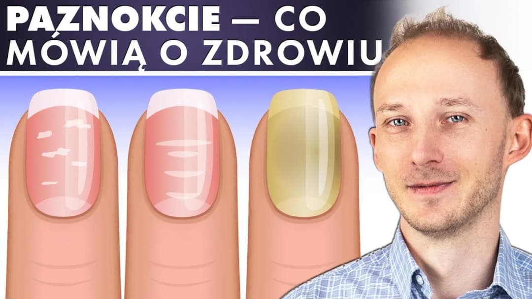 Jak wygląda zdrowy paznokieć? Oto cechy, które musisz znać